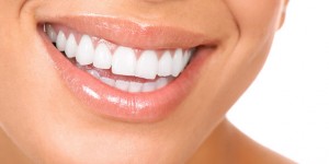 Dentacare Leistungen Bleaching