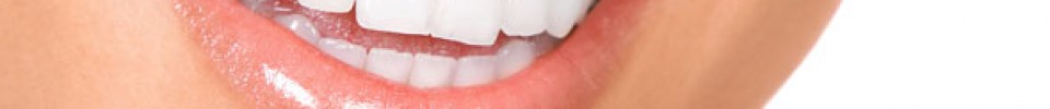 Dentacare Leistungen Bleaching