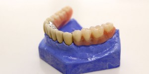 Dentacare Leistungen Prothetik