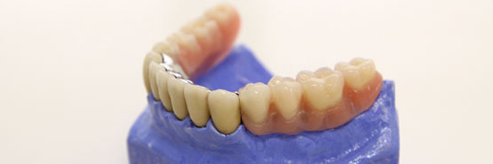 Dentacare Leistungen Prothetik